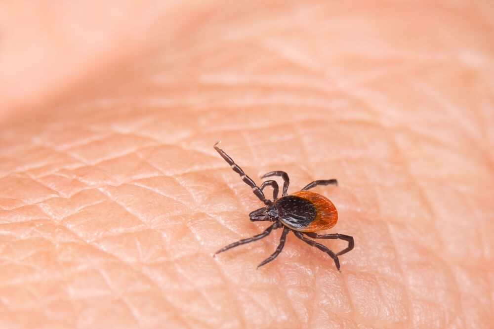 Tick on human skin, closeup